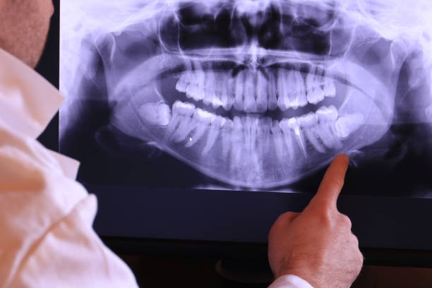 Best Emergency Dental Care for Broken or Chipped Teeth in Oakhurst, CA